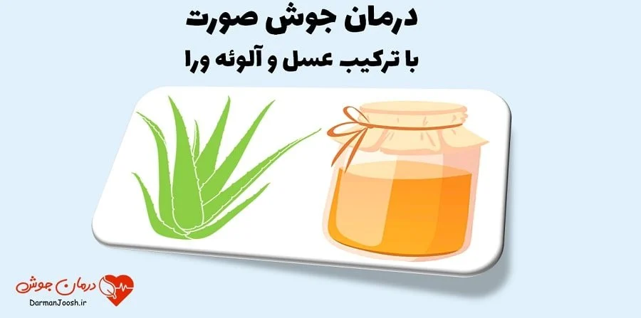 بهترین ماسک طبیعی برای درمان جوش صورت چیست؟