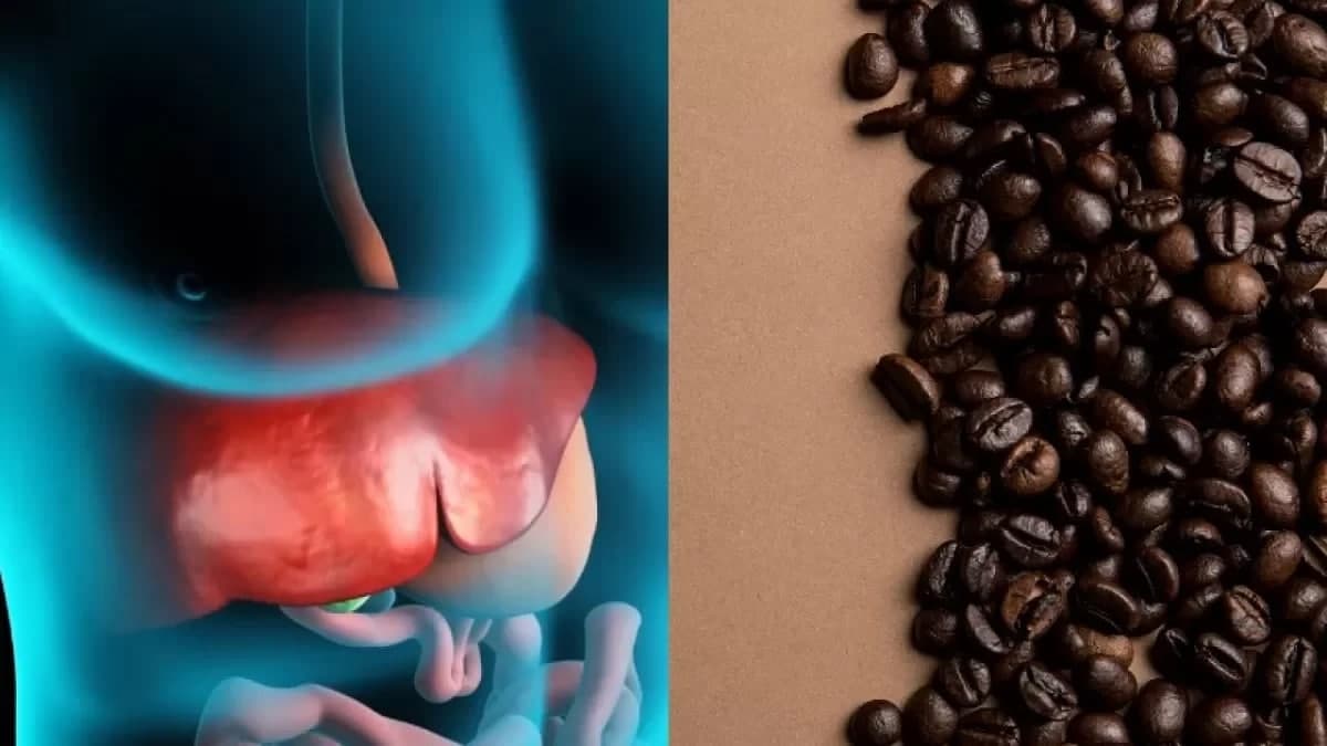 تأثیر قهوه موکا در کاهش خطر ابتلا به بیماری کبد چرب