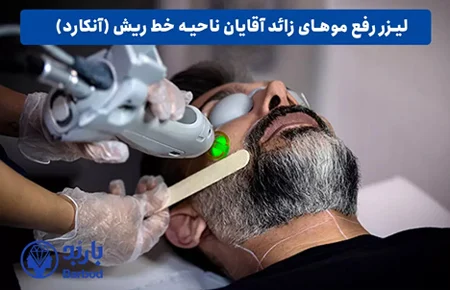 قیمت لیزر صورت مردان چقدر است؟