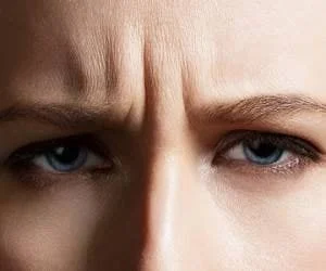 روش دائمی از بین بردن خط اخم