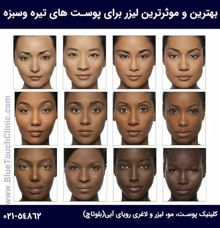بهترین دستگاه لیزر برای پوست تیره کدام است