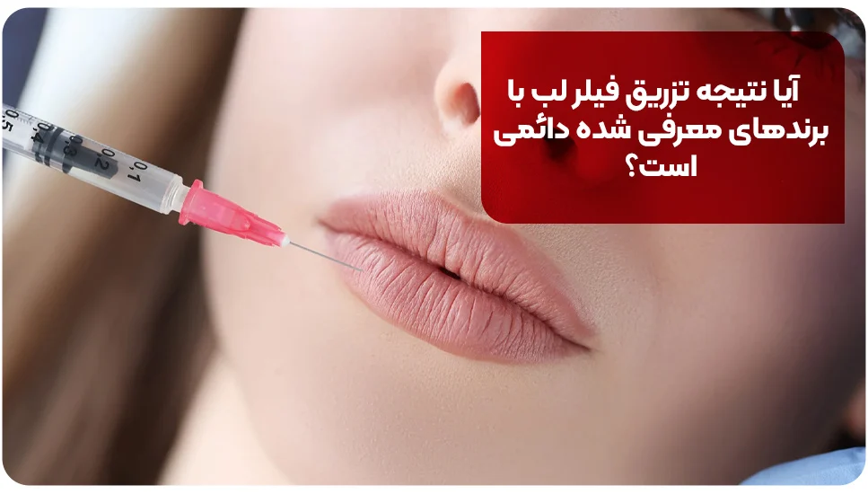 آیا نتیجه تزریق فیلر لب با برندهای معرفی شده دائمی است؟
