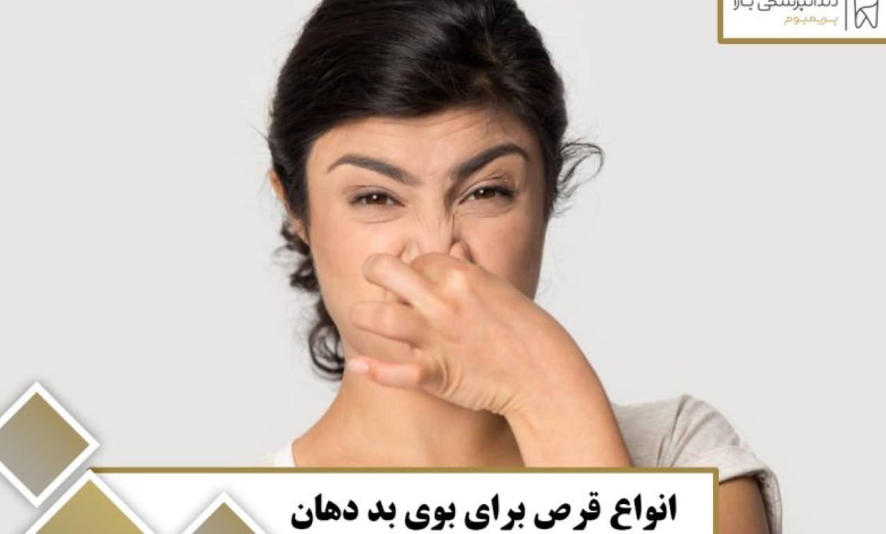 بهترین قرص برای بوی بد دهان