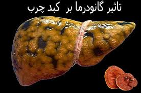 آیا قهوه گانودرما برای کبد چرب مفید است؟