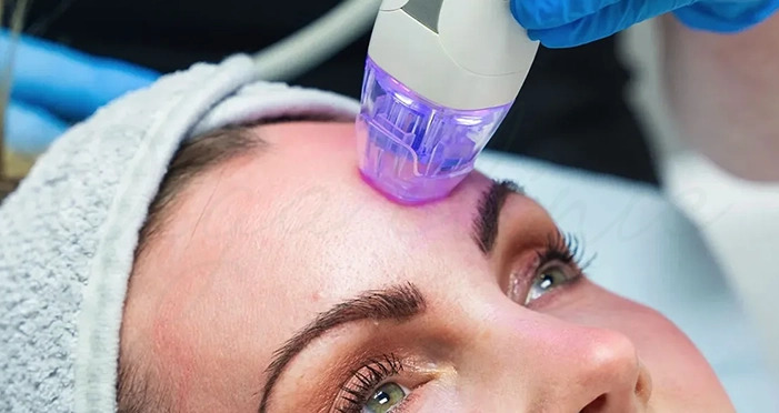 آر اف فرکشنال چیست و چه کاربردی دارد؟